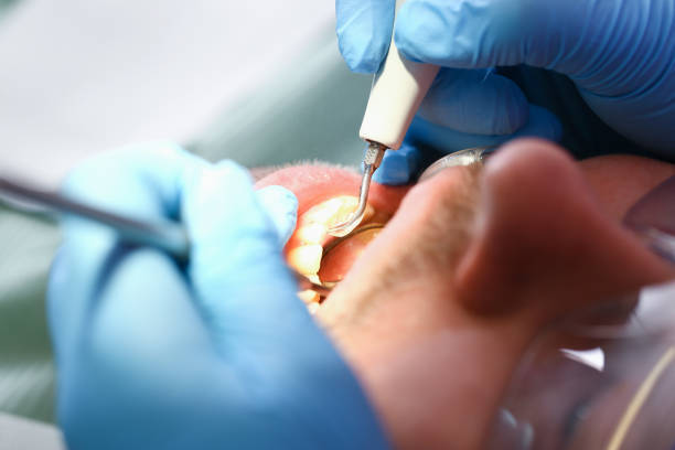 Best Broken Tooth Emergency  in Petersburg, WV