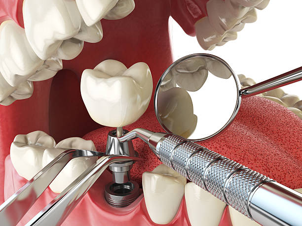 Professional Emergency Dentist in WV